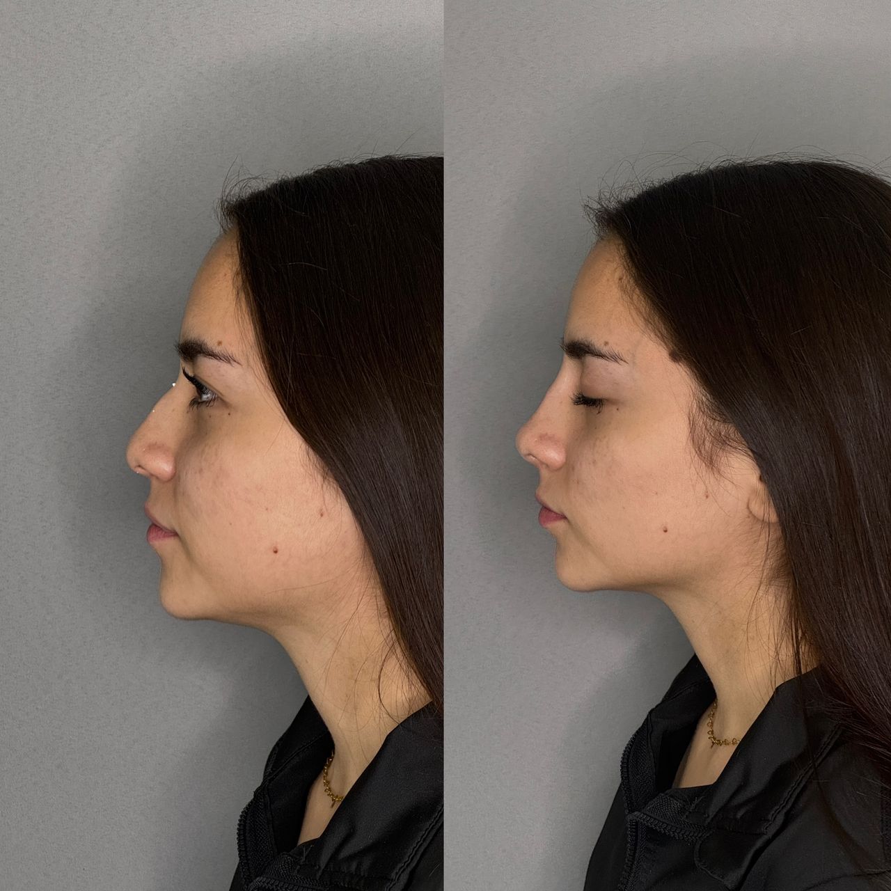 Juan Antonio Munguia Baltodano-5