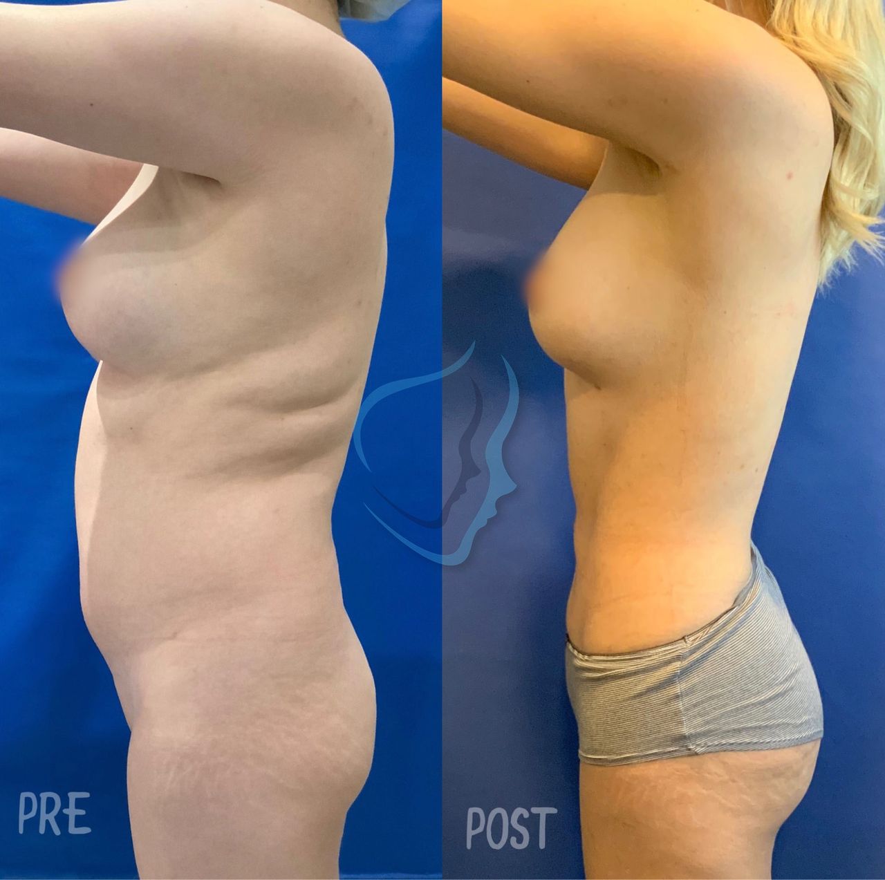 Giuseppe Tanzillo-20