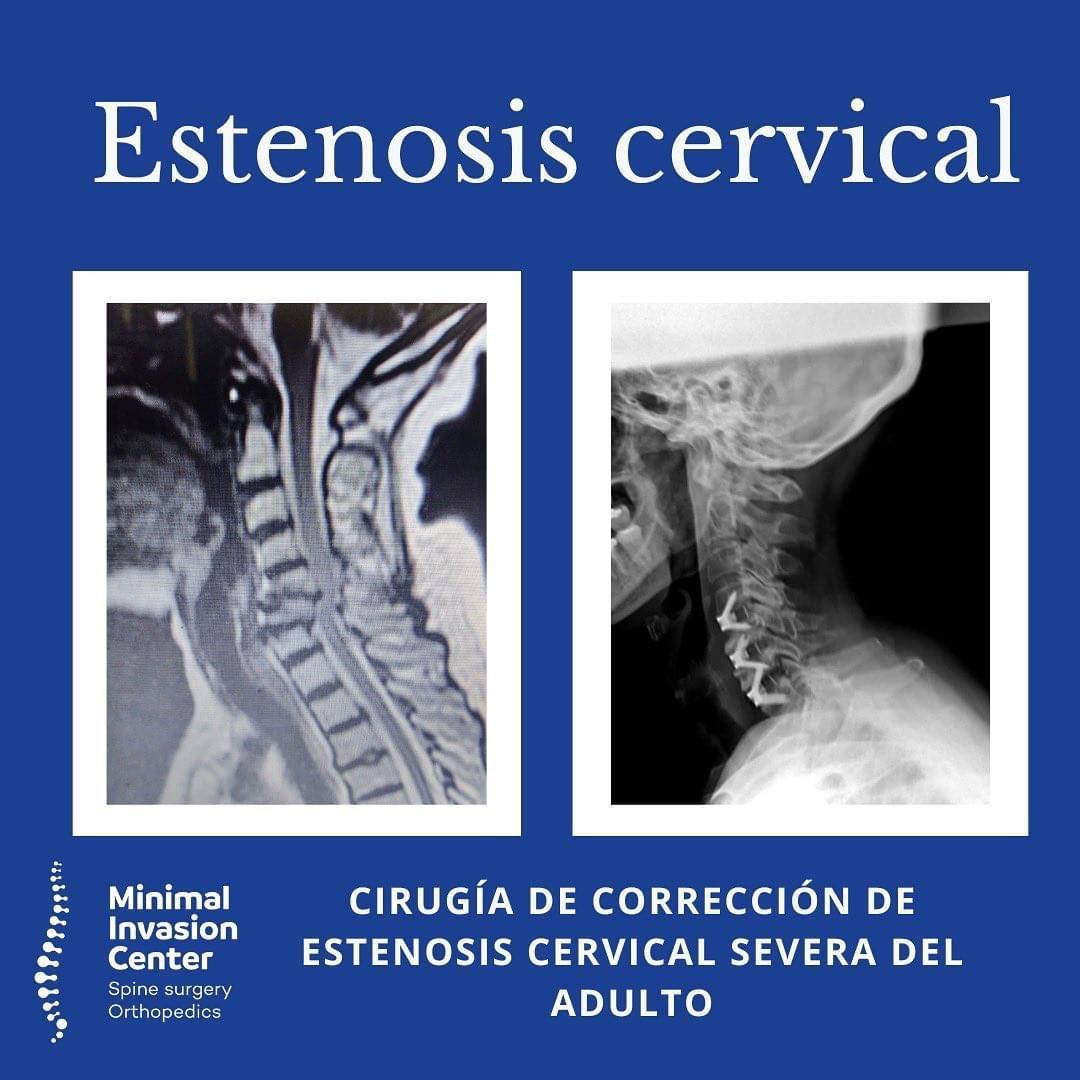 Omar Marroquín Herrera-18