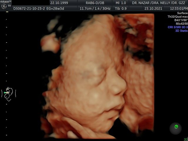 Miguel Angel González Nazar-10