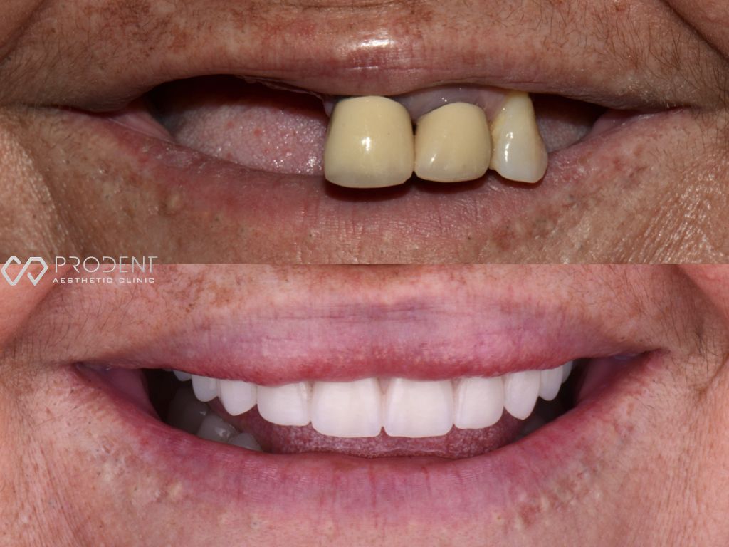 Ulises Pérez Murillo-67