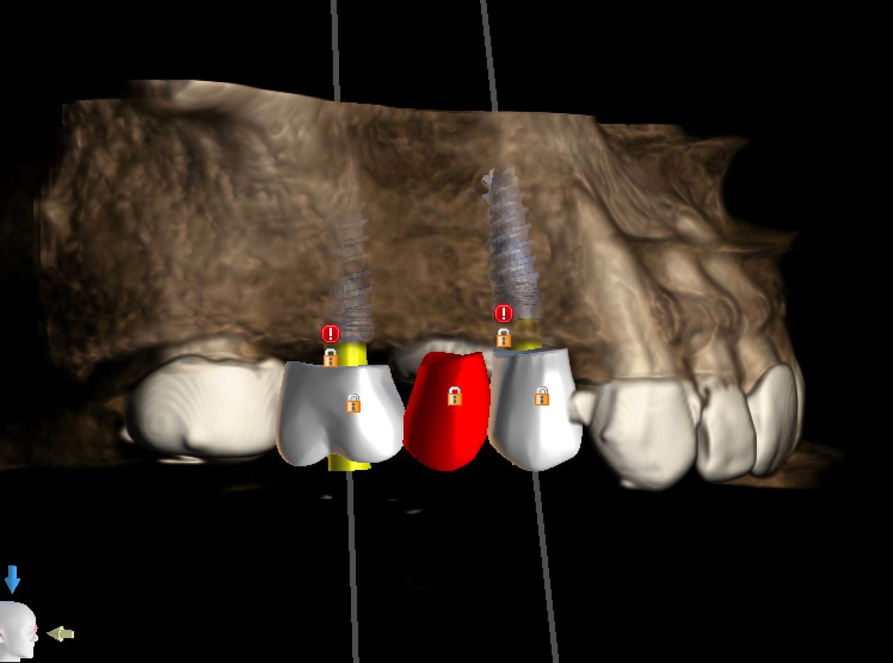 Andrés Tovar López-20