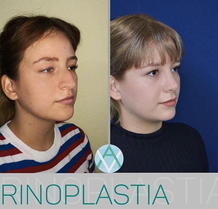 Alfonso Villaseñor Herrero-2