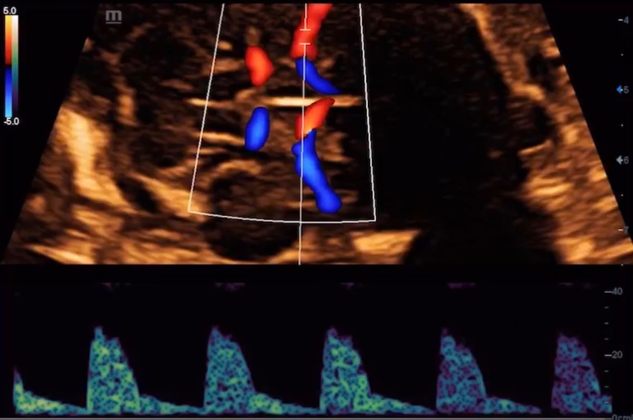 Ricardo Morales Velázquez-0