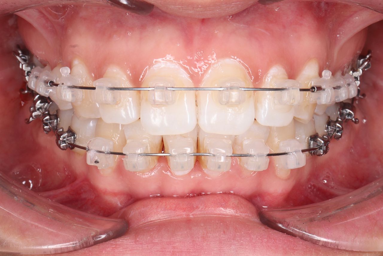 Claudia Lizárraga-4