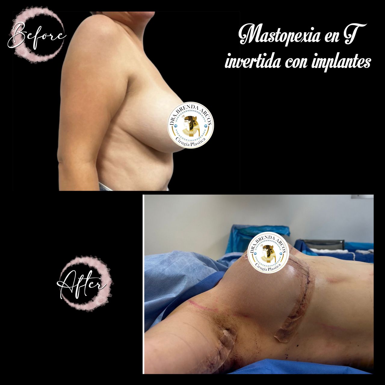 Brenda Arcos Vera-21