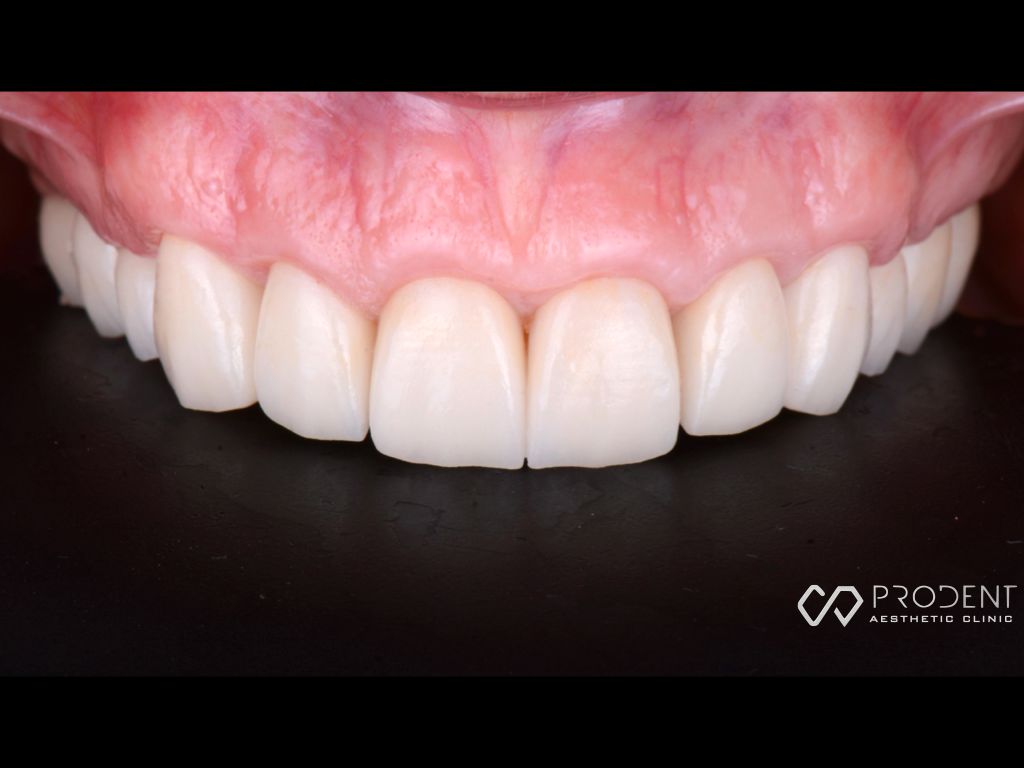 Ulises Pérez Murillo-105