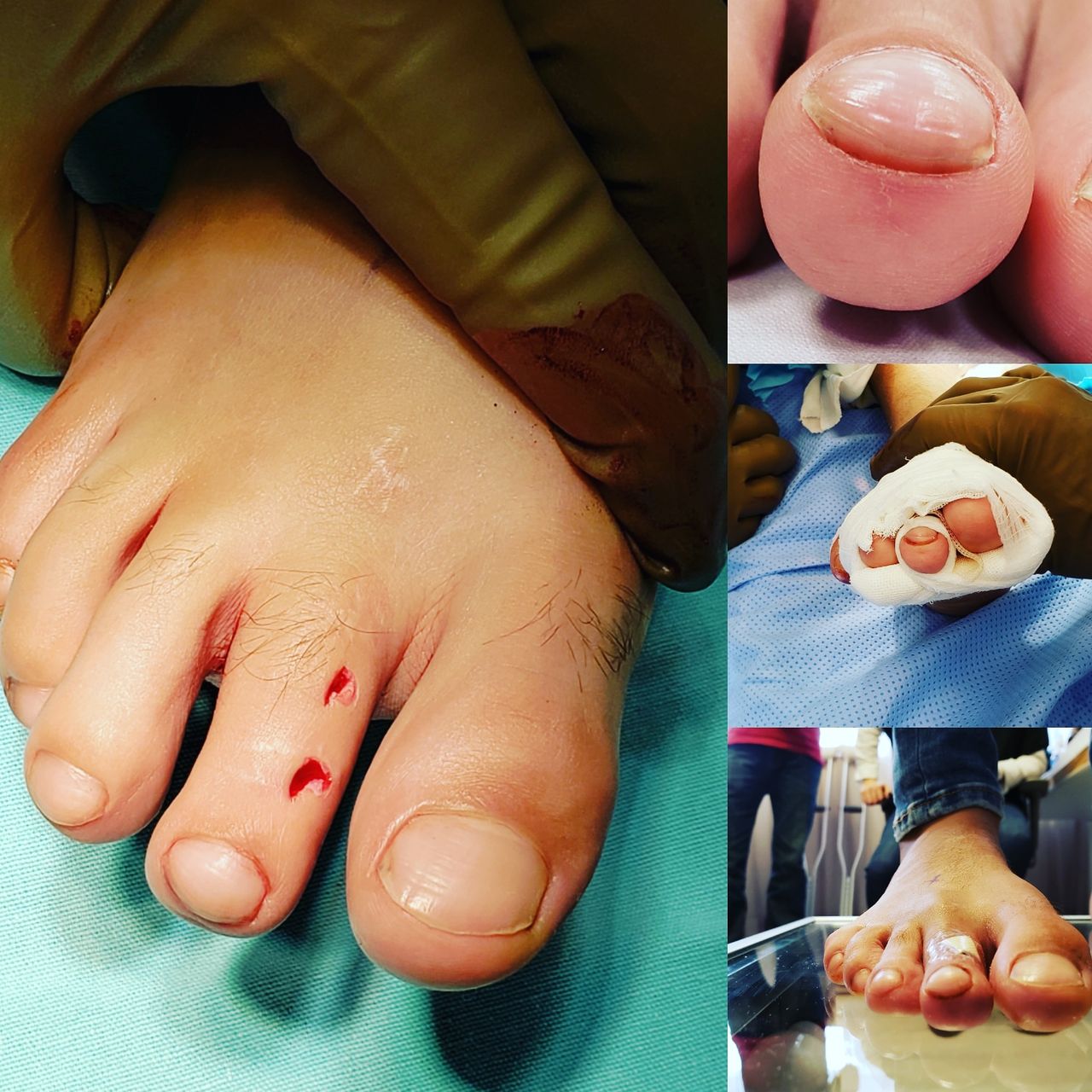 Alfonso Meza Vernis-64