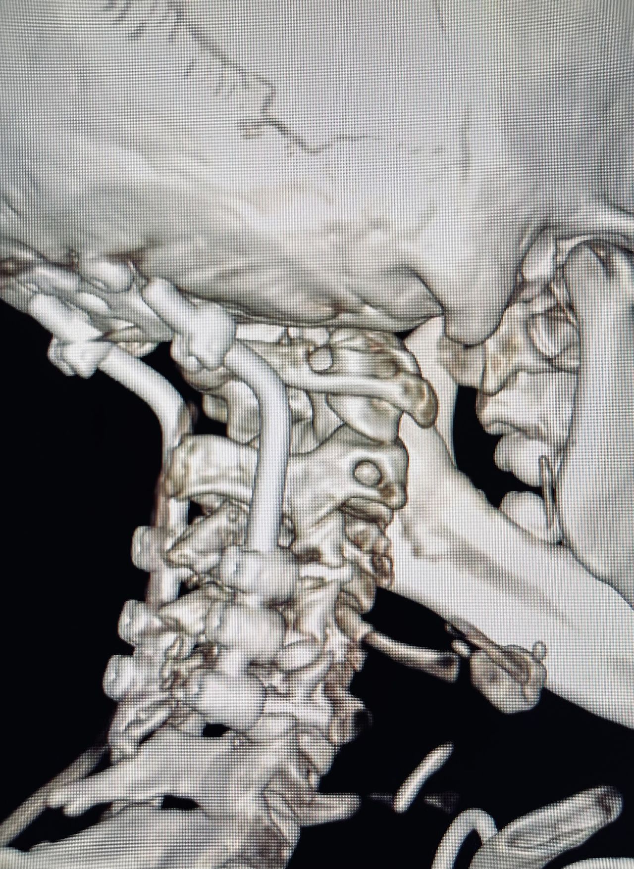 Juan Antonio Alvaro Heredia-14