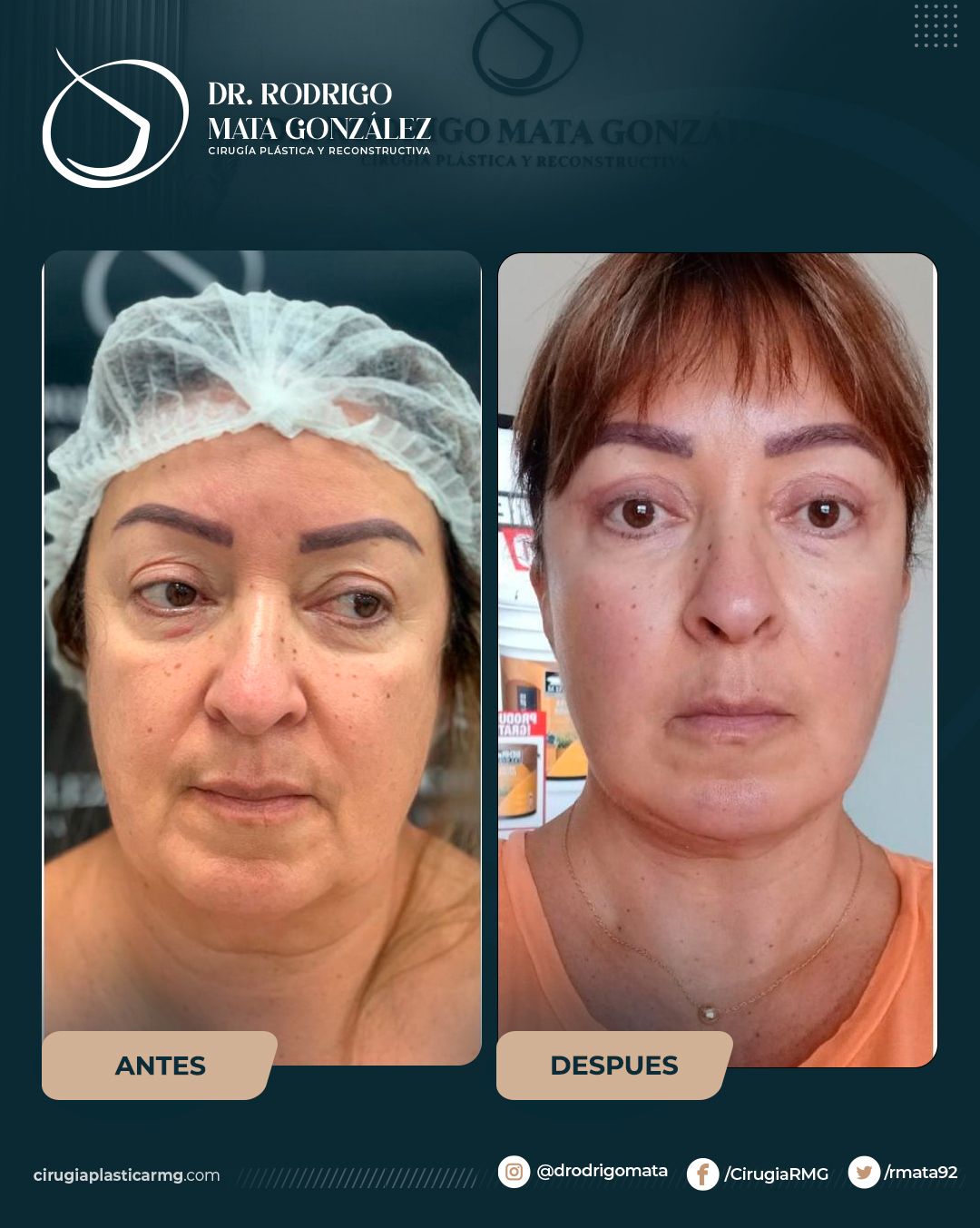 Rodrigo Mata Gonzalez-24