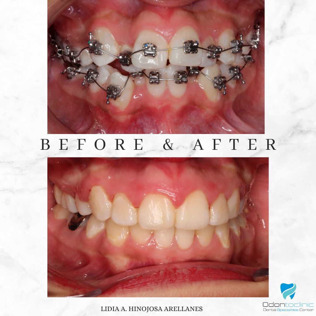 Lidia Abigail Hinojosa Arellanes-12