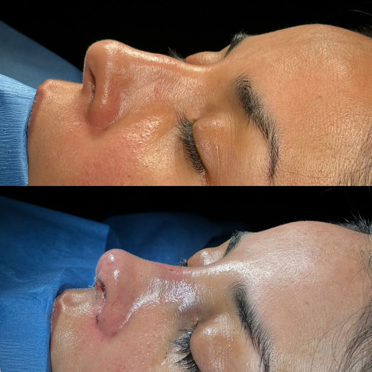 Angel Castro Urquizo-115