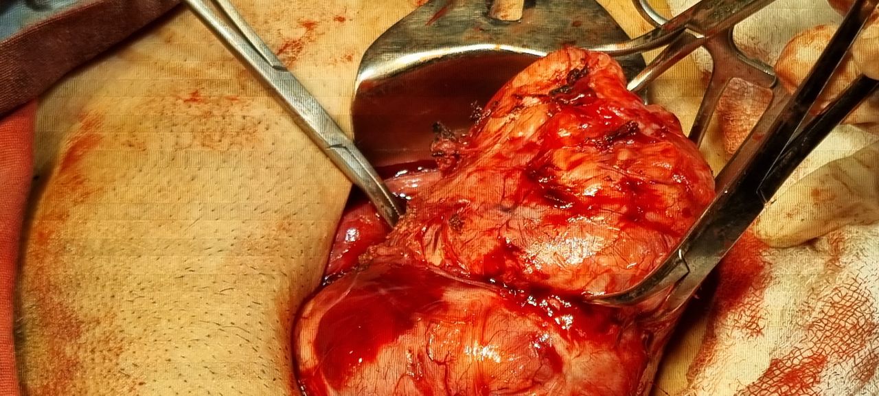 Martha Ivette Mejia Chavez-12