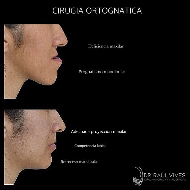 Raúl José Vives Serrano-16