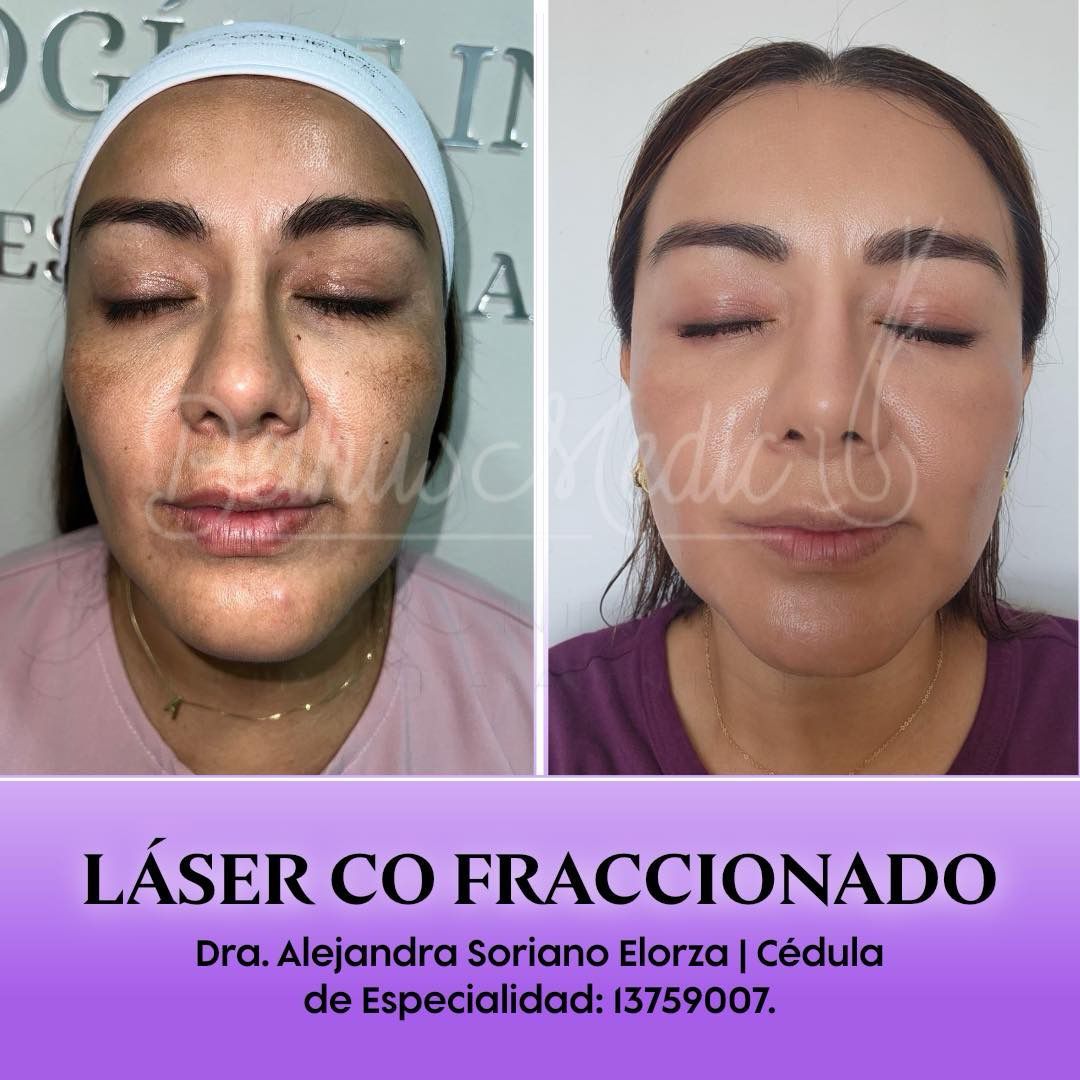 Alejandra Soriano Elorza-72