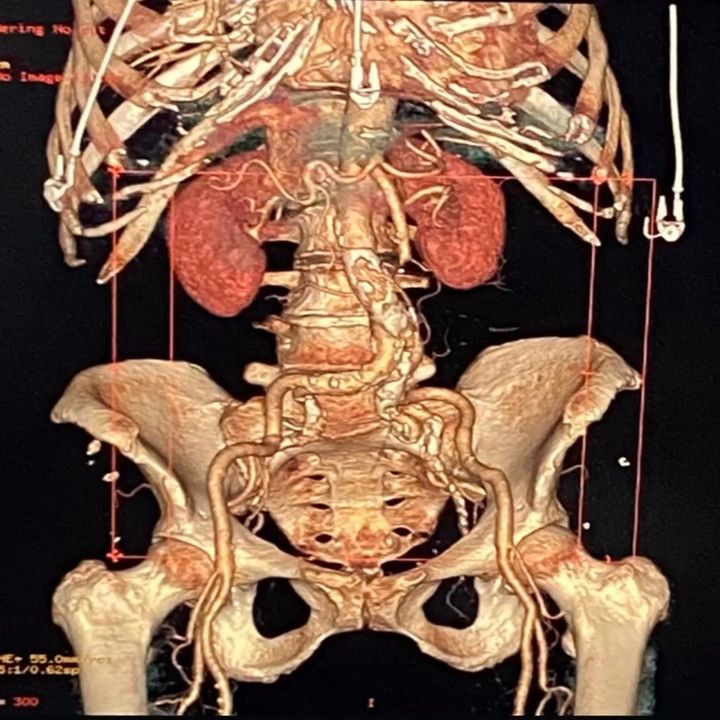 Oscar Alejandro López Ramos-3