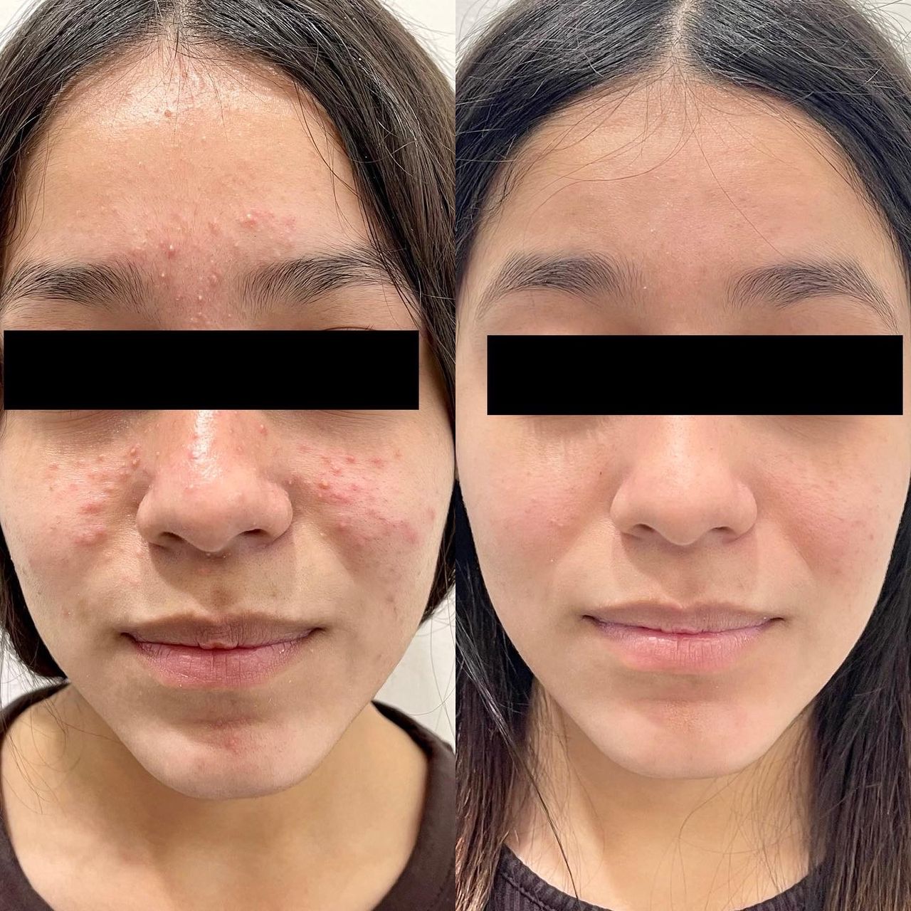 Arturo Robles Tenorio-4