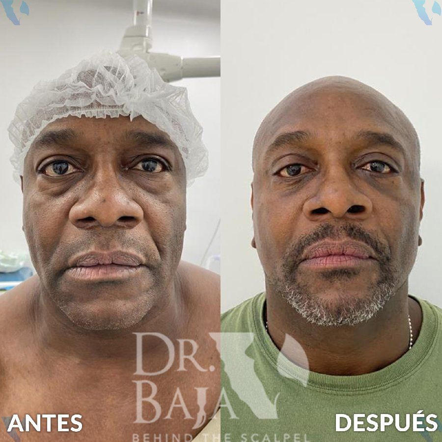 Renato Rodríguez Hirales-31