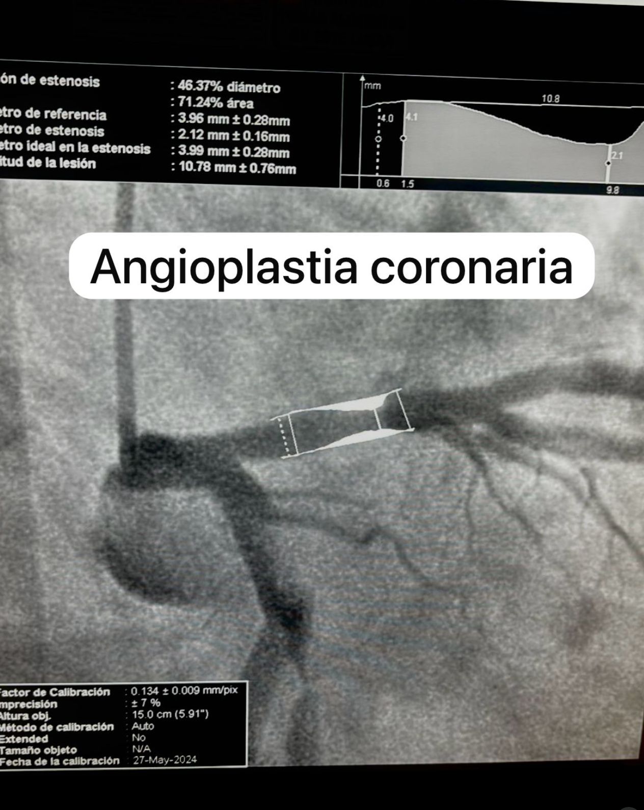 Mario Humberto Lozano Quintas-12
