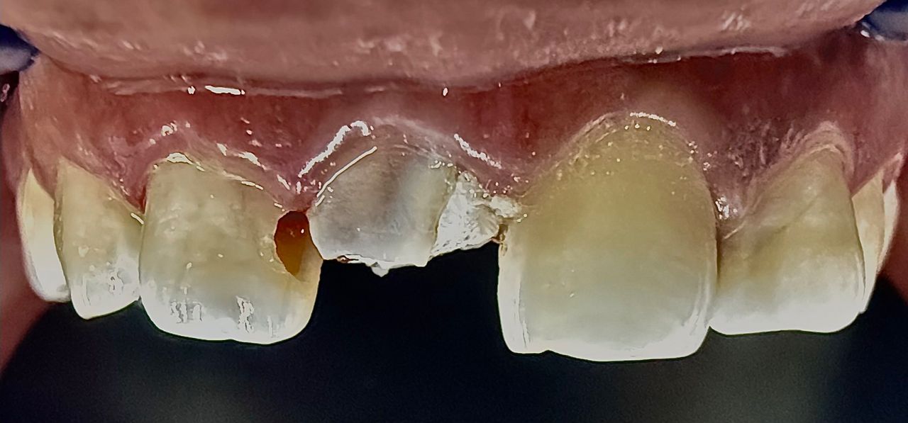 Jair Contreras García-53