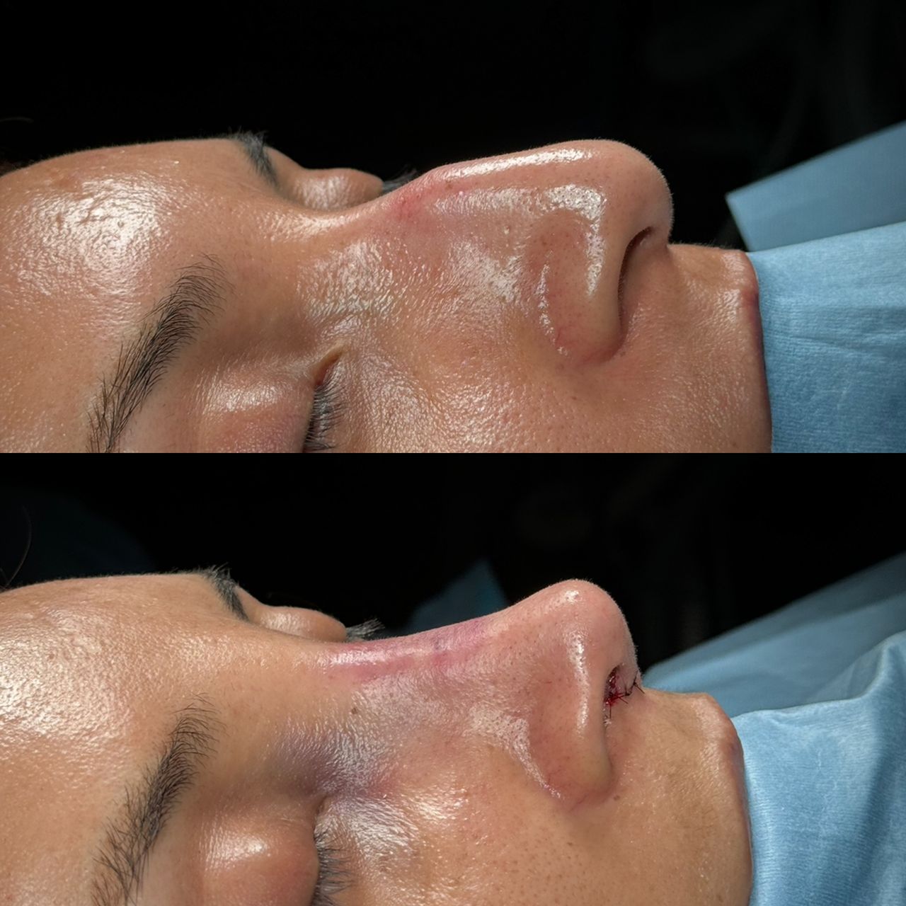 Angel Castro Urquizo-143