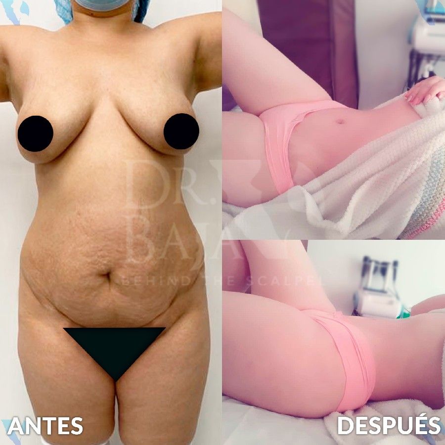 Renato Rodríguez Hirales-5