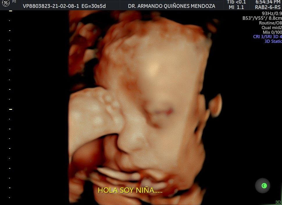 Armando Quiñones Mendoza-17