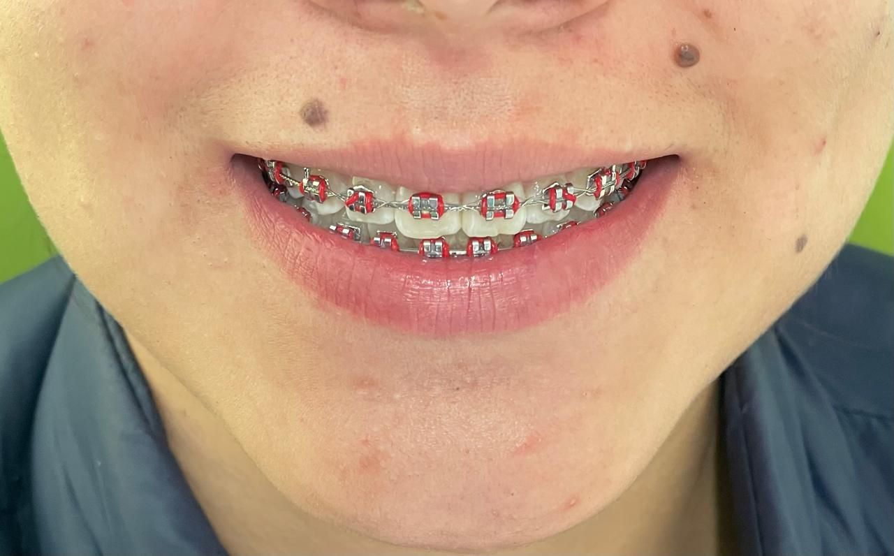 Anuar Becerril Castro-12