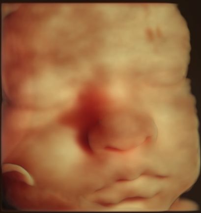 Fernando Nieto Landeros-0