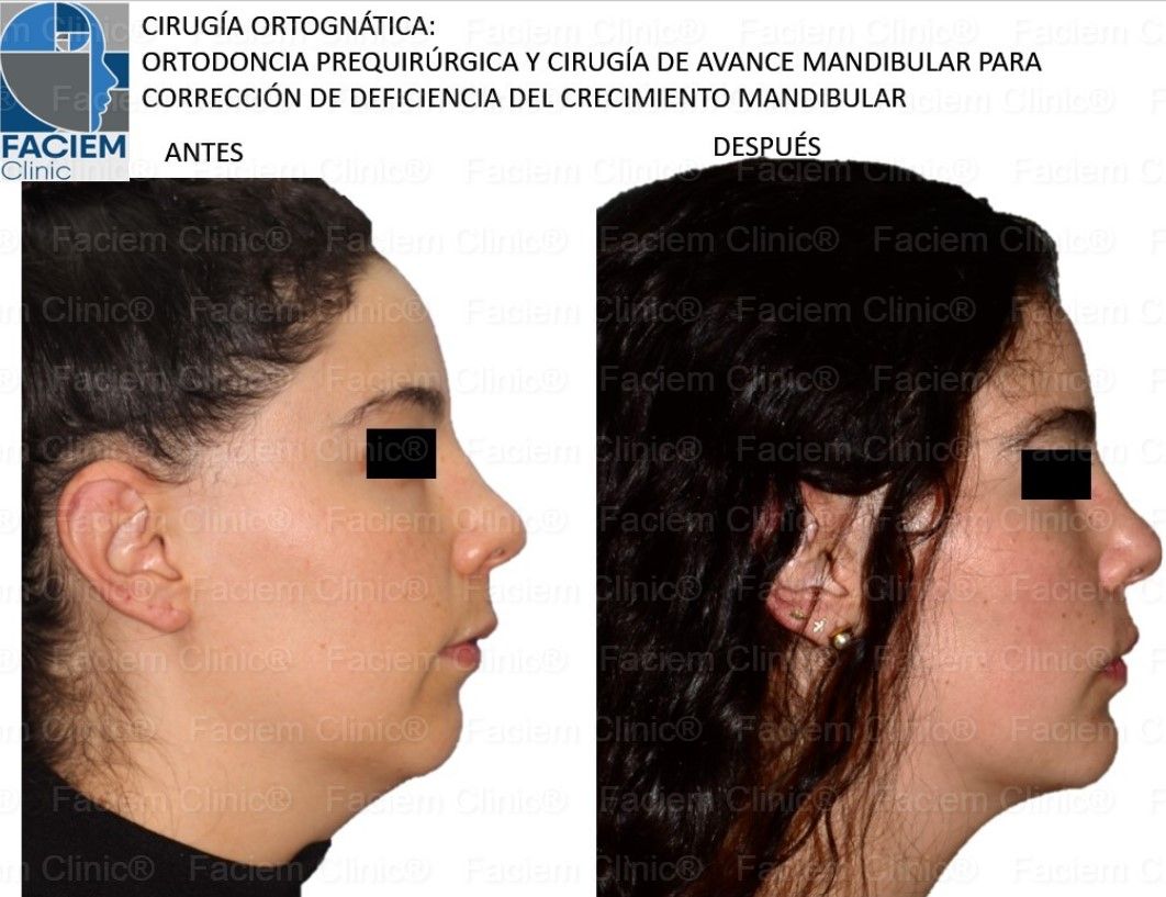 Arlen Colín Ordaz-4