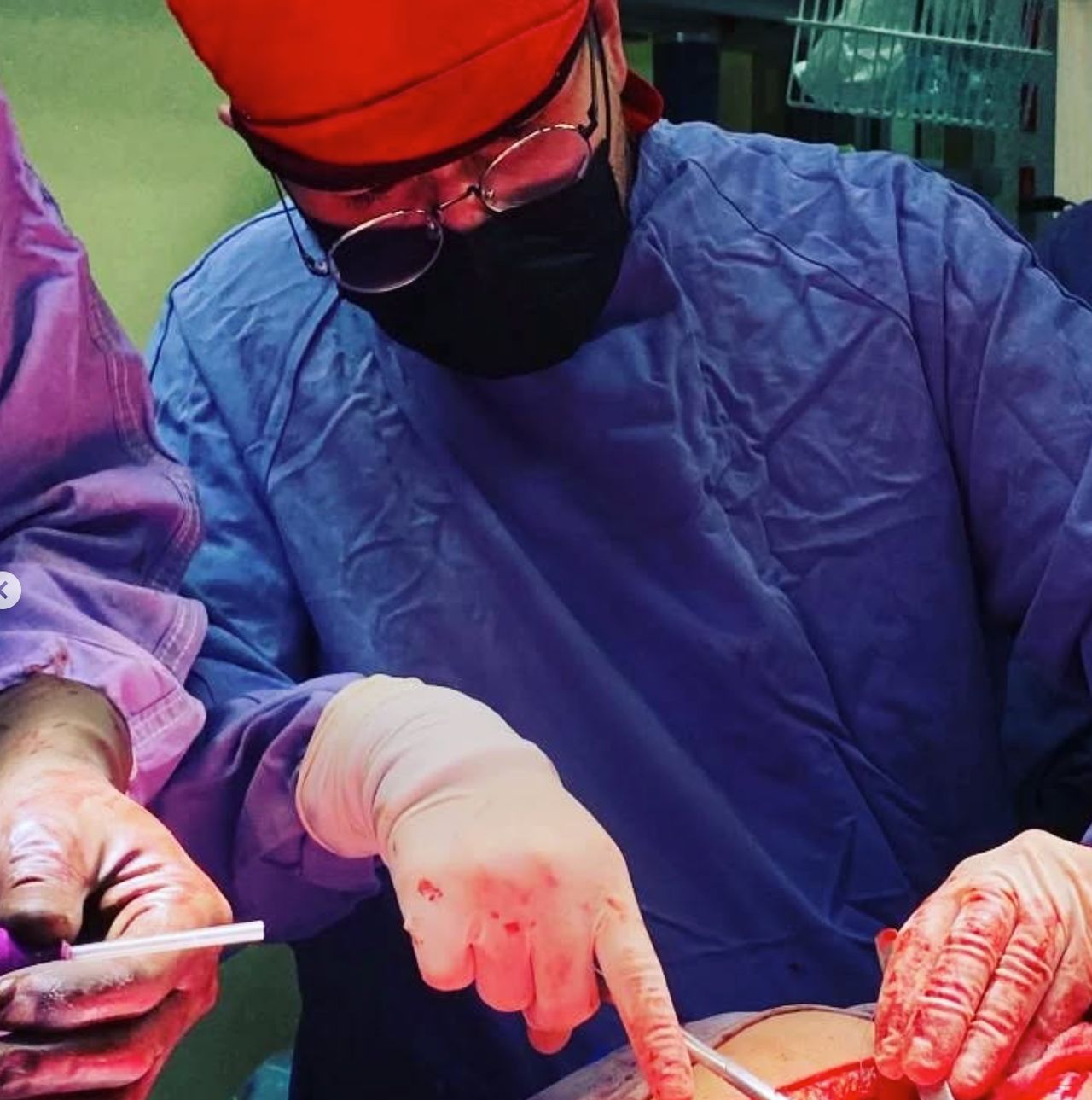 Hugo Alberto Escalante Escobedo-41