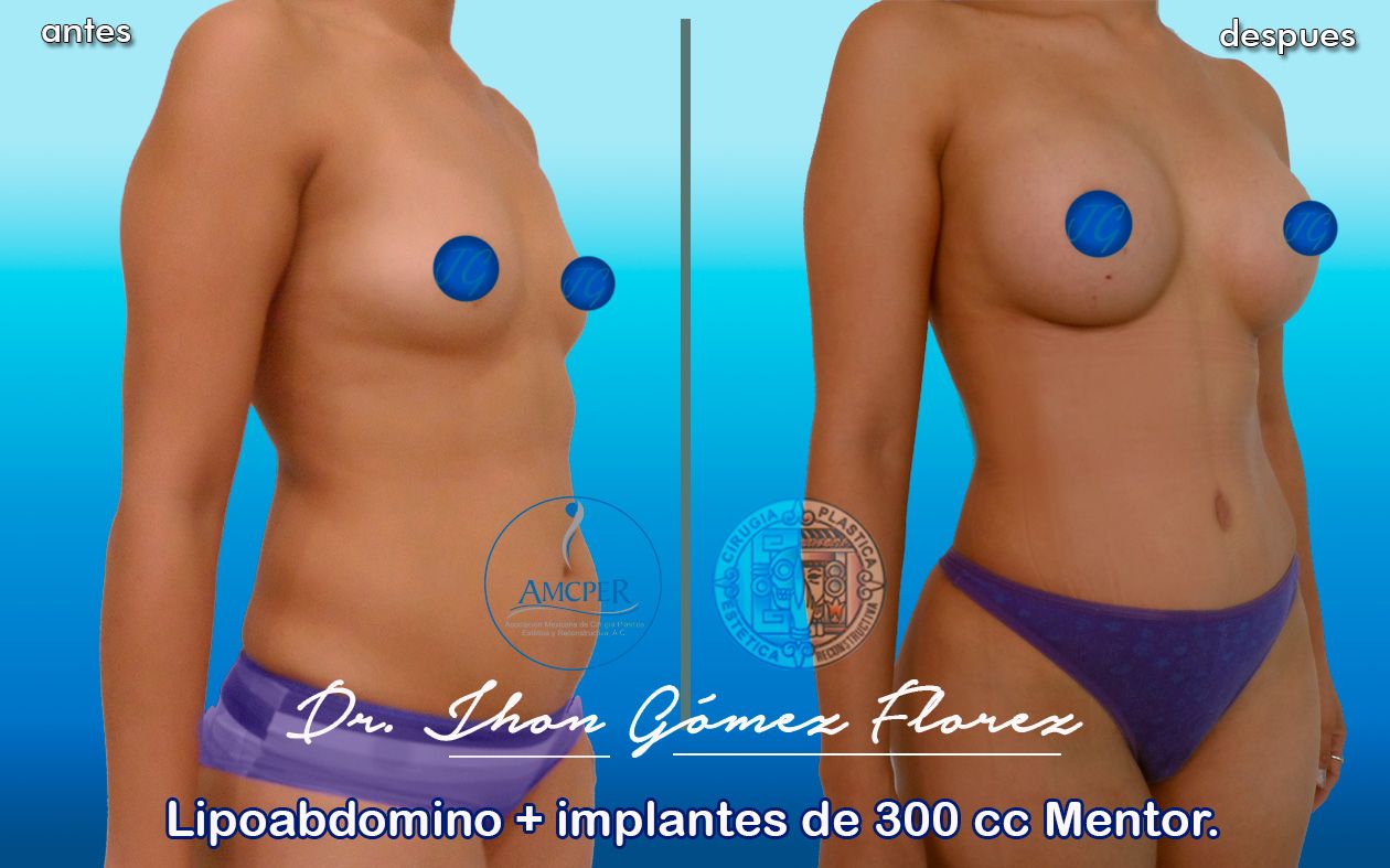 Jhon César Gómez Florez-46