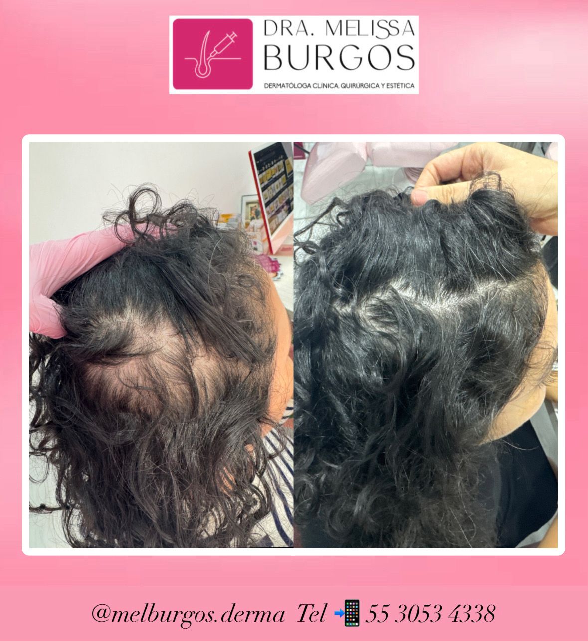 Melissa Burgos Romero-5