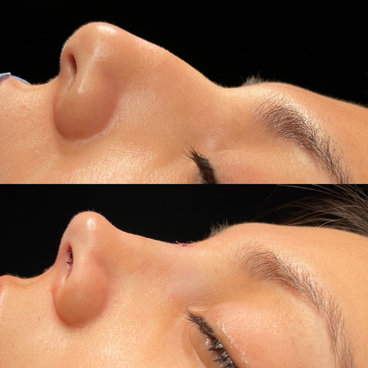 Angel Castro Urquizo-165