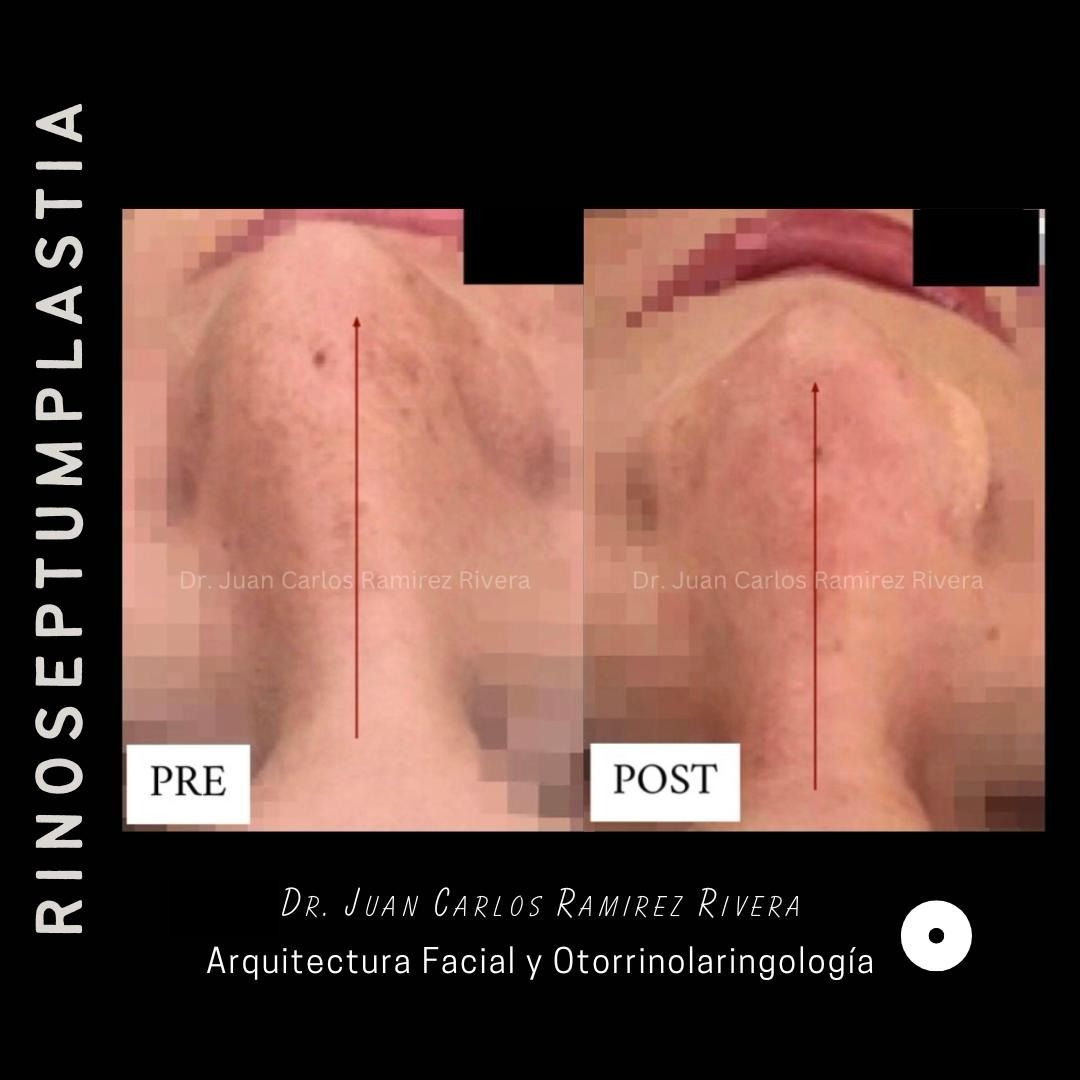 Juan Carlos Ramirez Rivera-0