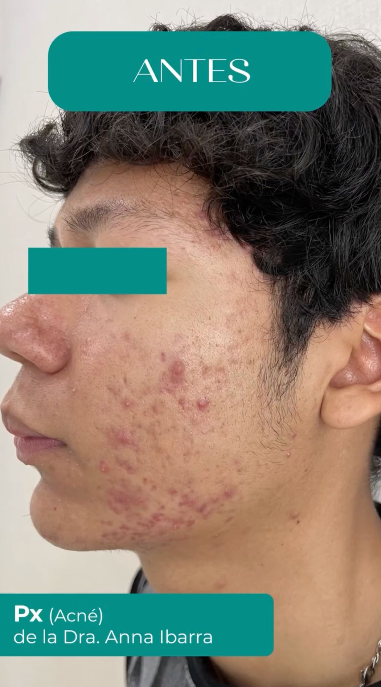 Anna Luisa Ibarra Puentes-17