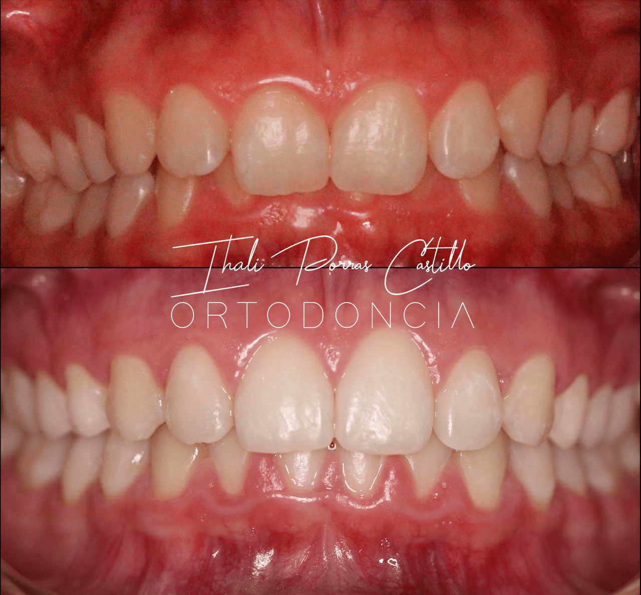 Ihali Porras Castillo-12