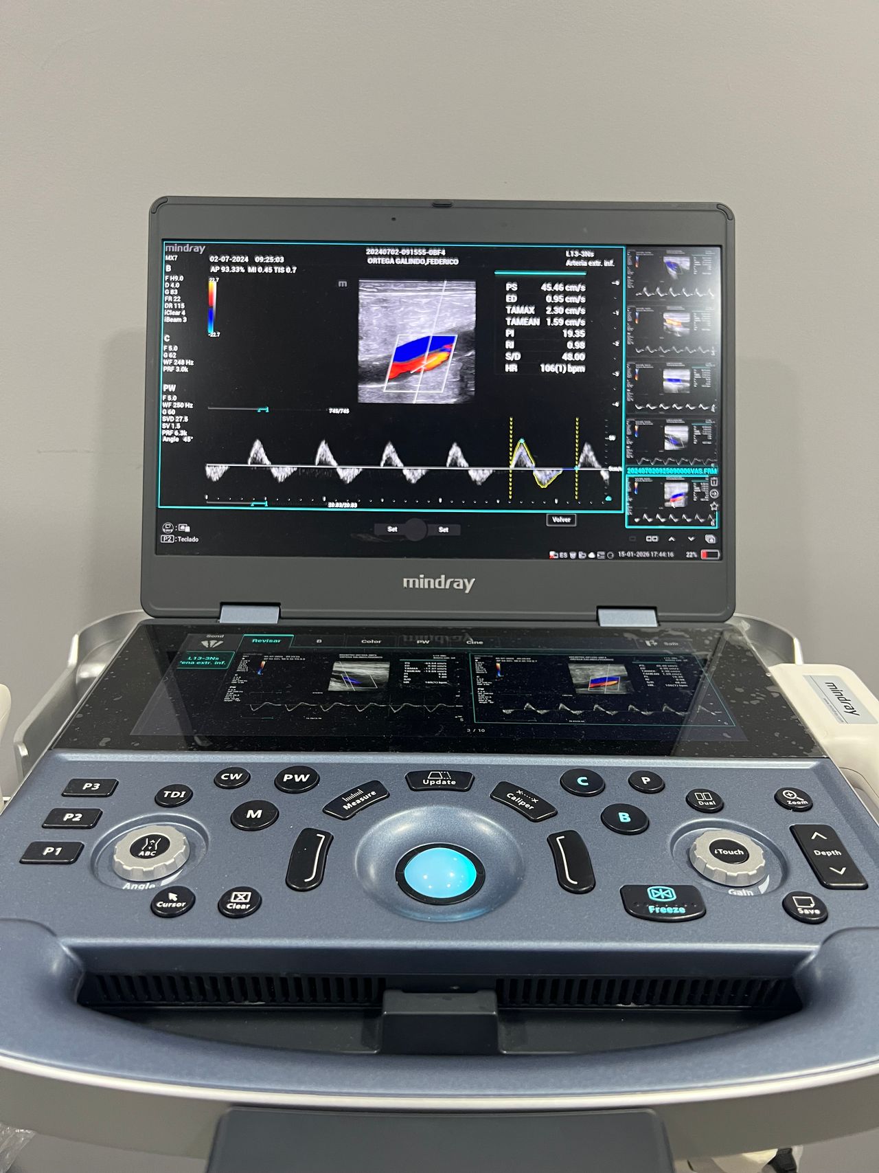 Delfino Pérez Ugarte-0