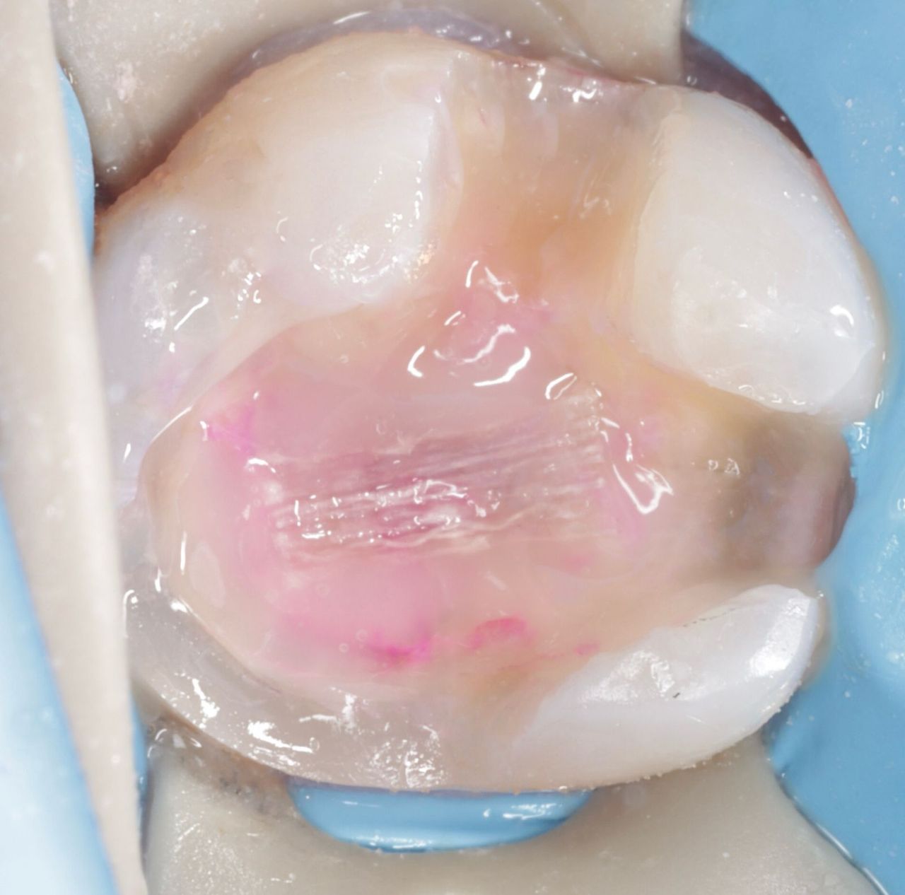 Fredy Alejandro Roblero Gónzalez-55