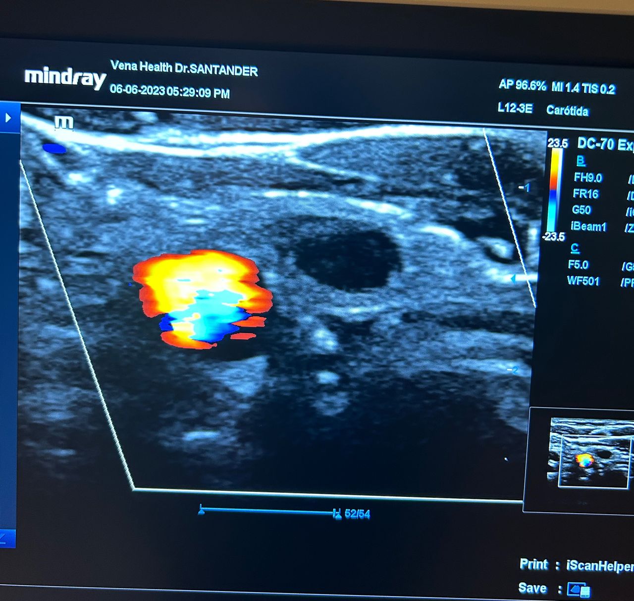 Giovanny Santander Becerra-23