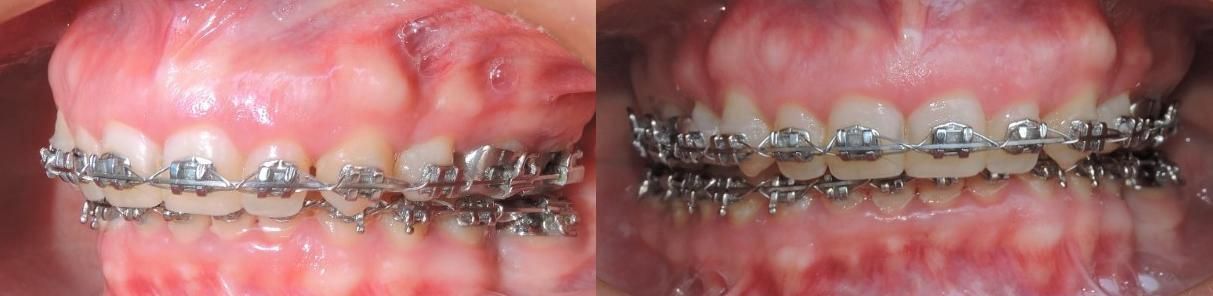 Alberto Wintergerst Fisch-31