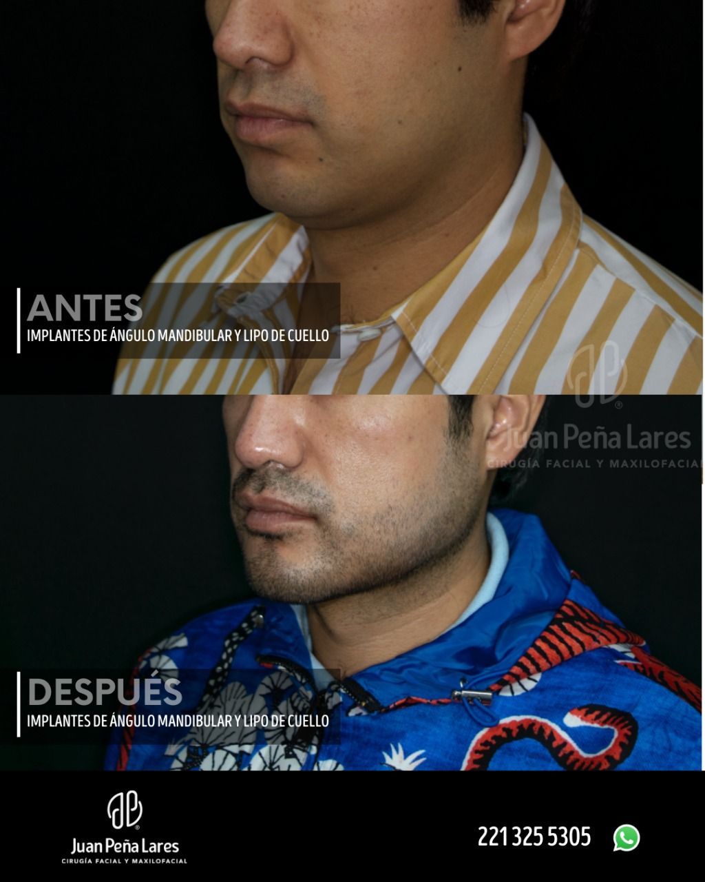 Juan Peña Lares-35