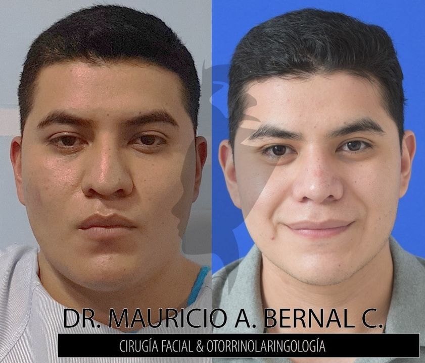 Mauricio Alejandro Bernal Carreon-23