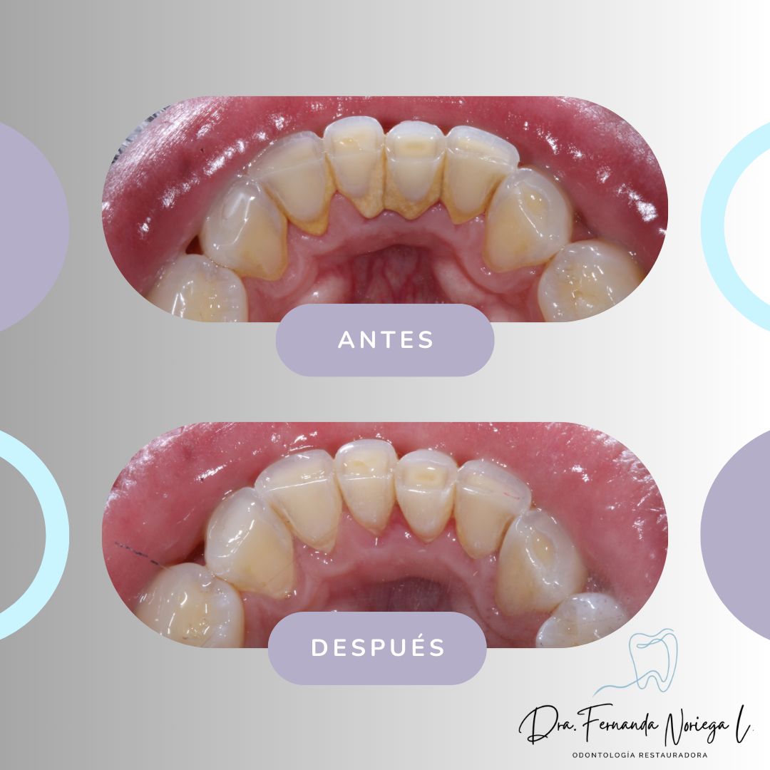 Fernanda Noriega Limón-8