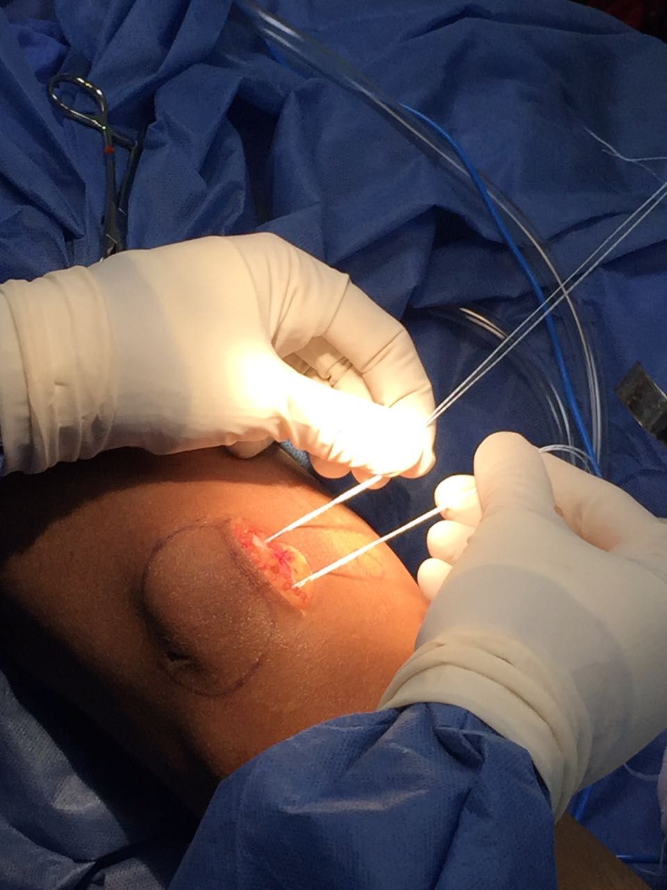 Carlos Alberto Romero Sosa-4