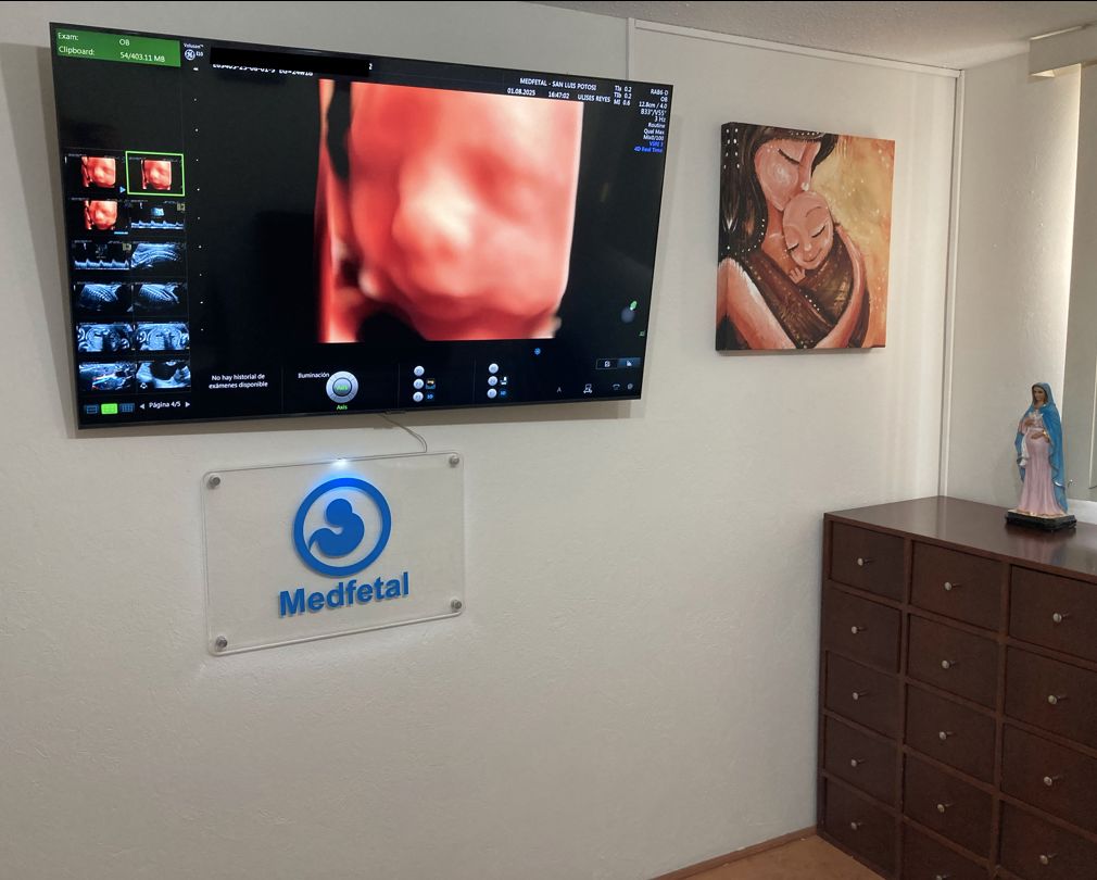 Manuel Ulises Reyes Hernández-5