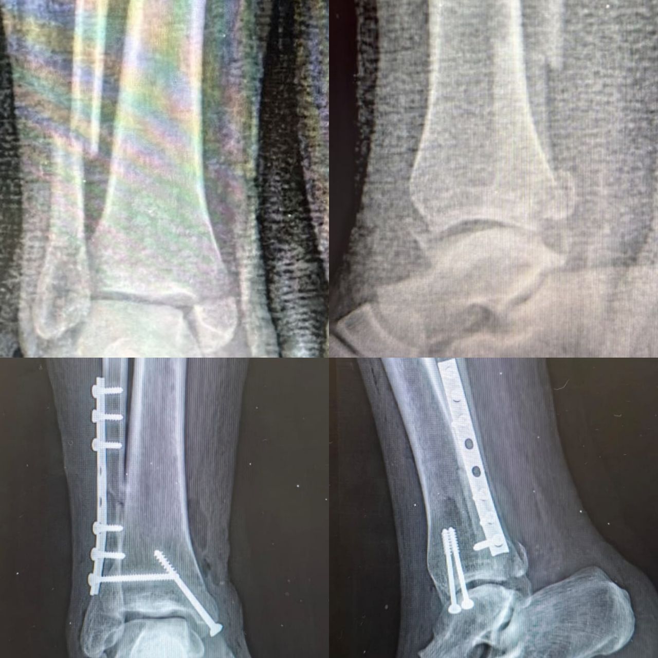 Elías Benjamín Preciado Tovar-3