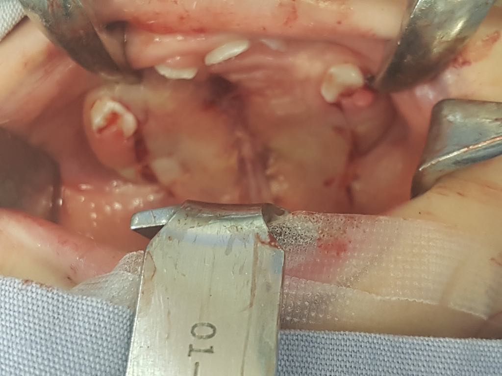 Zeyda Oliman Hoyos-2