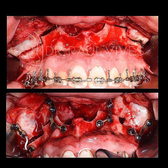 Raúl José Vives Serrano-1