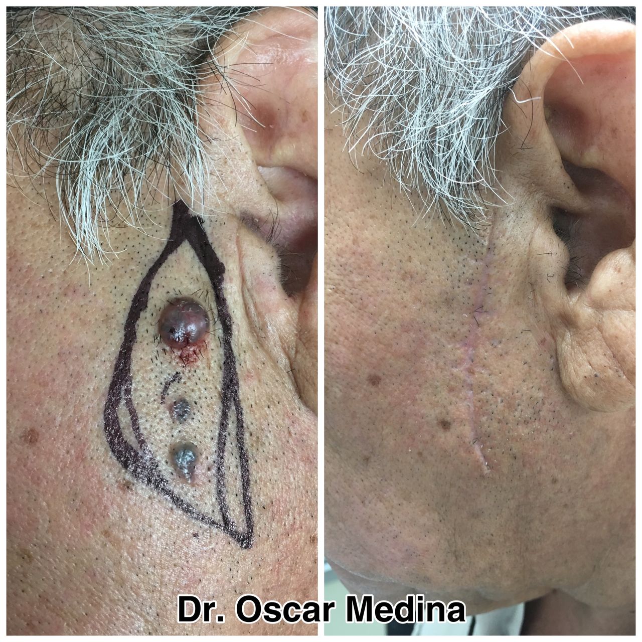 Oscar Alejandro Medina Navarro-0